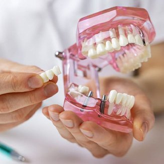 Dentist using model to talk about dental implants