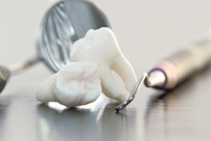 Two wisdom teeth on a table next to dental tools